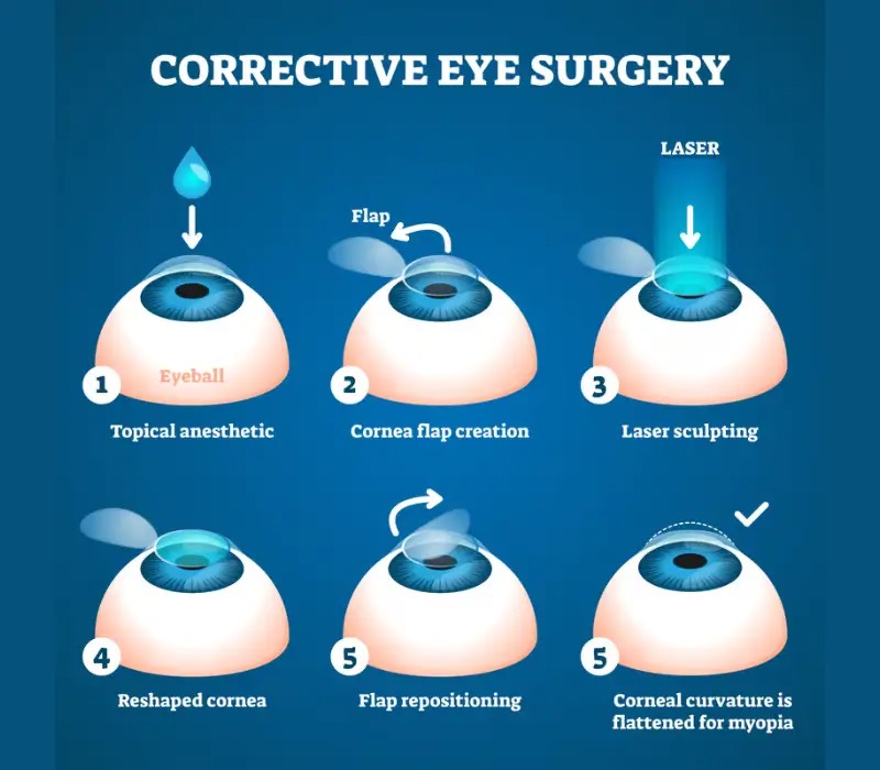Near Vision Eye Surgery in Jalandhar