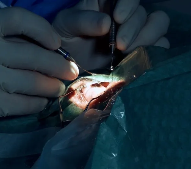 Ear microsurgery in Jalandhar